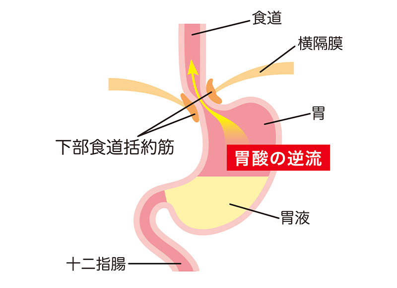 原因